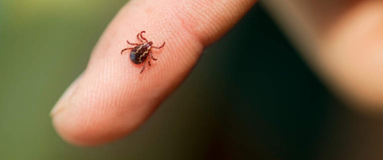 Tekenbeet Controleren: Voorkom Dat Je De Ziekte Van Lyme Krijgt