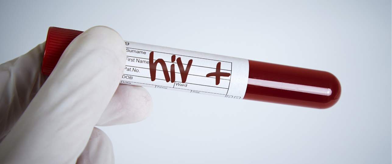 hiv