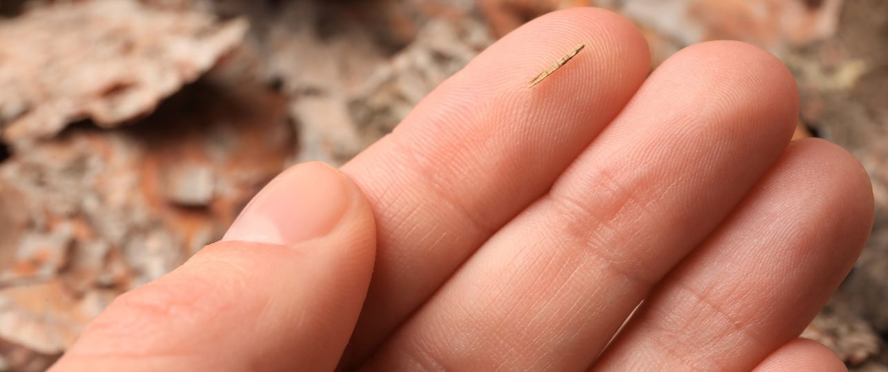 Splinter verwijderen, de beste tips om het veilig te doen