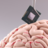 Implantaat hersenimplantaat brein-implantaat Neurolink Elon Musk